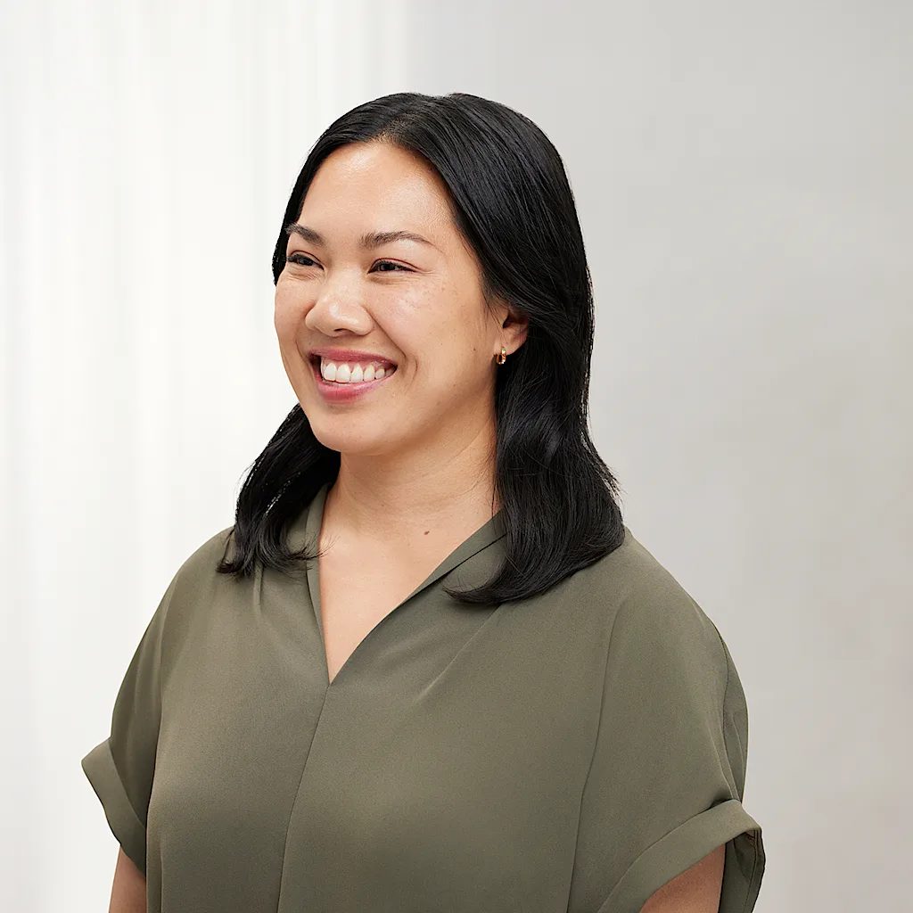 After Botox crows feet