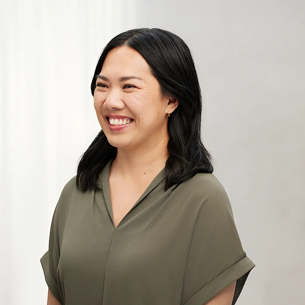 Before Botox crows feet