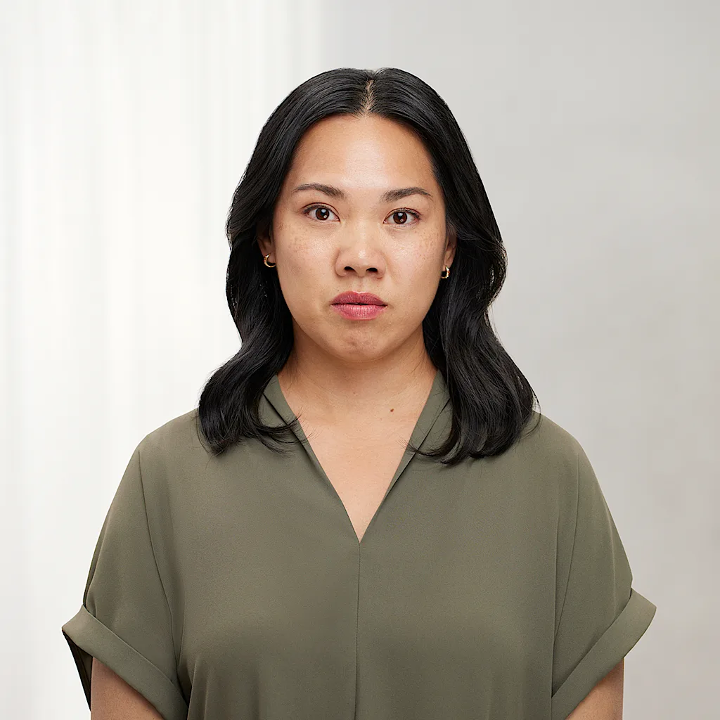 After Botox forehead