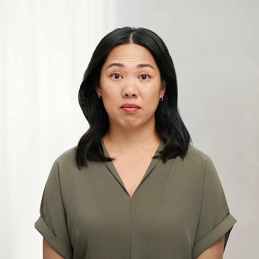 Before Botox forehead