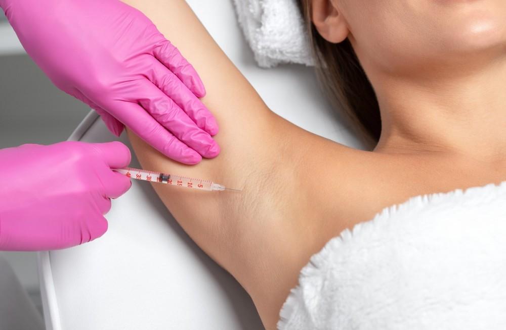 Underarm hyperhidrosis Botox treatment