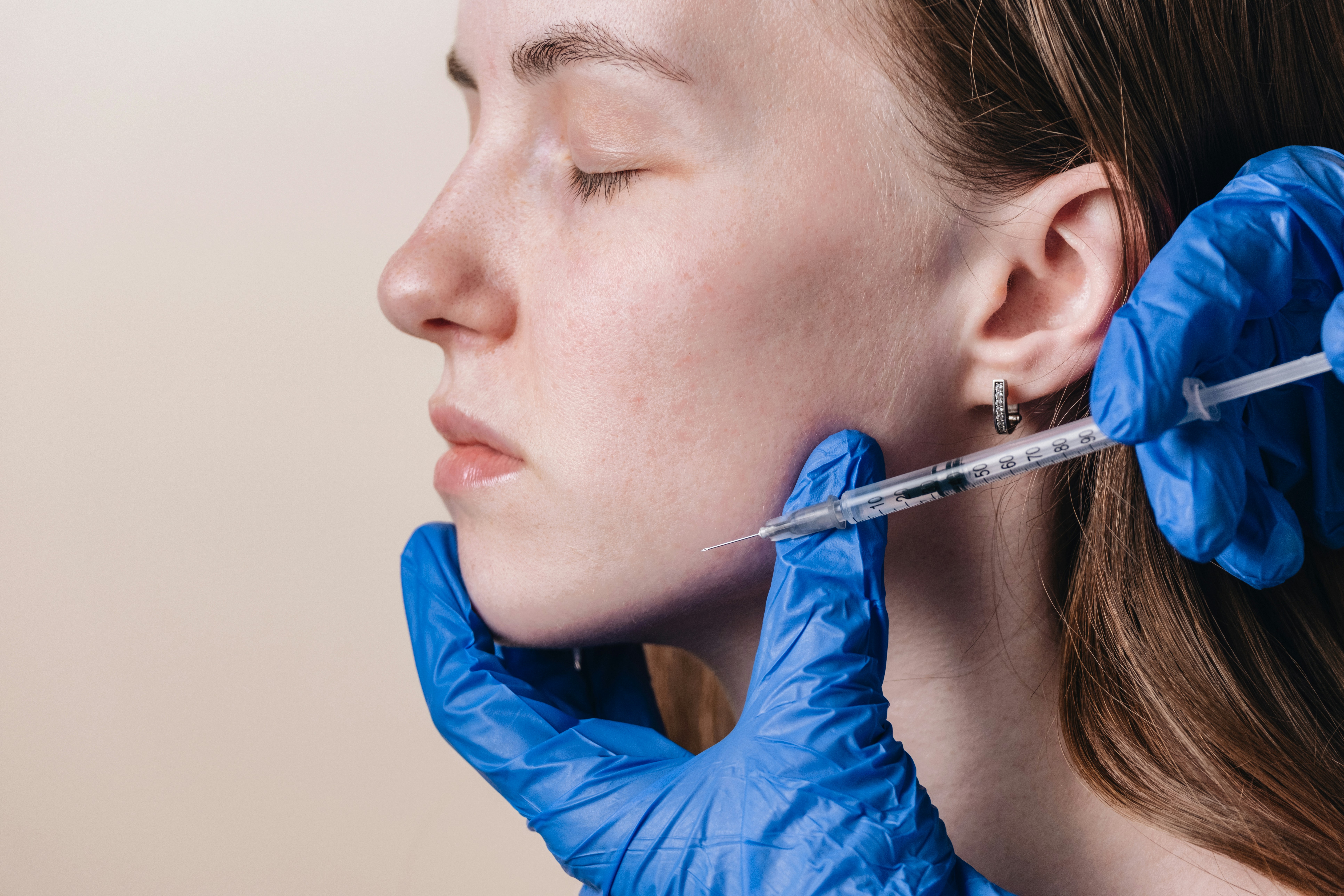 Botox for TMJ & Jaw treatment experience