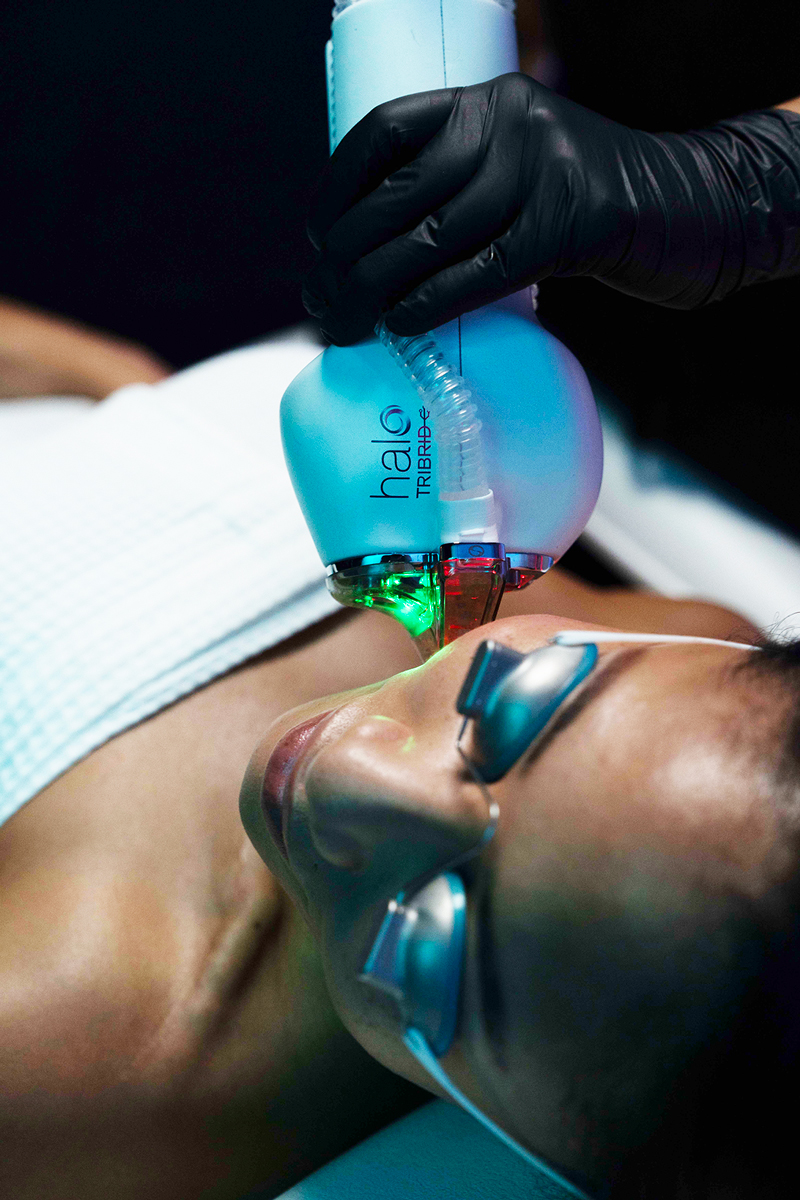 Halo hybrid fractional laser