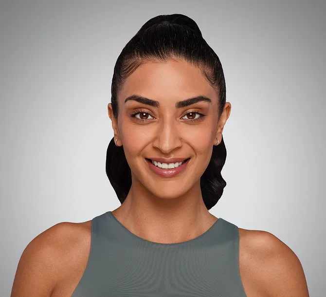 After Volbella lip filler