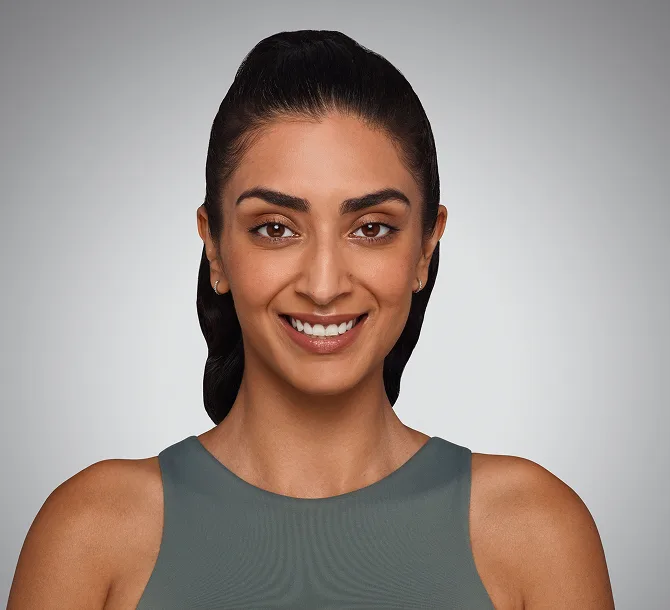 Before Volbella lip filler