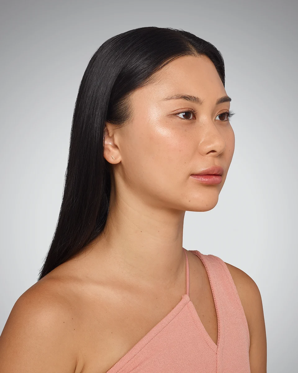 After Volbella, natural lip enhancement