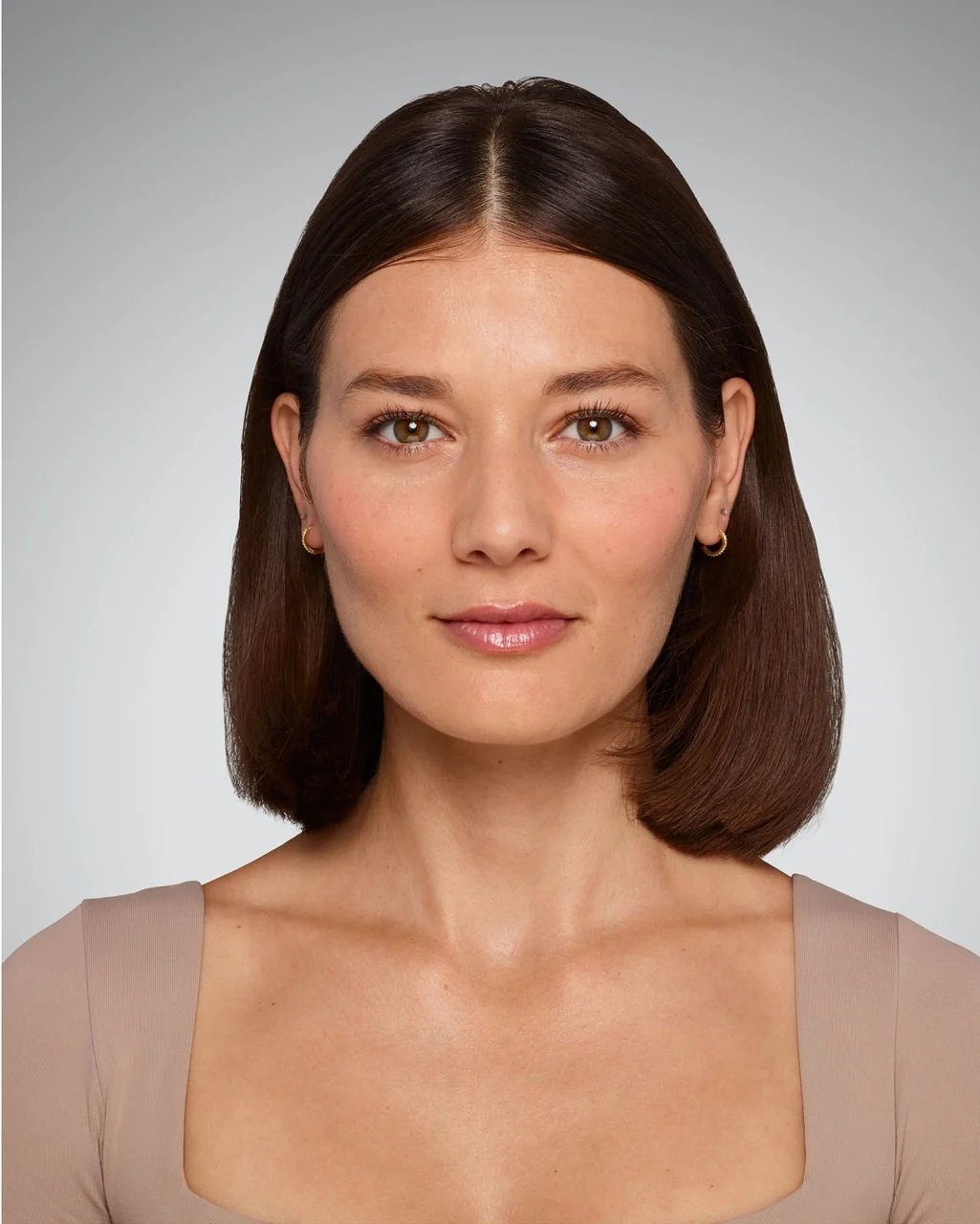 After Volbella, natural full lip result