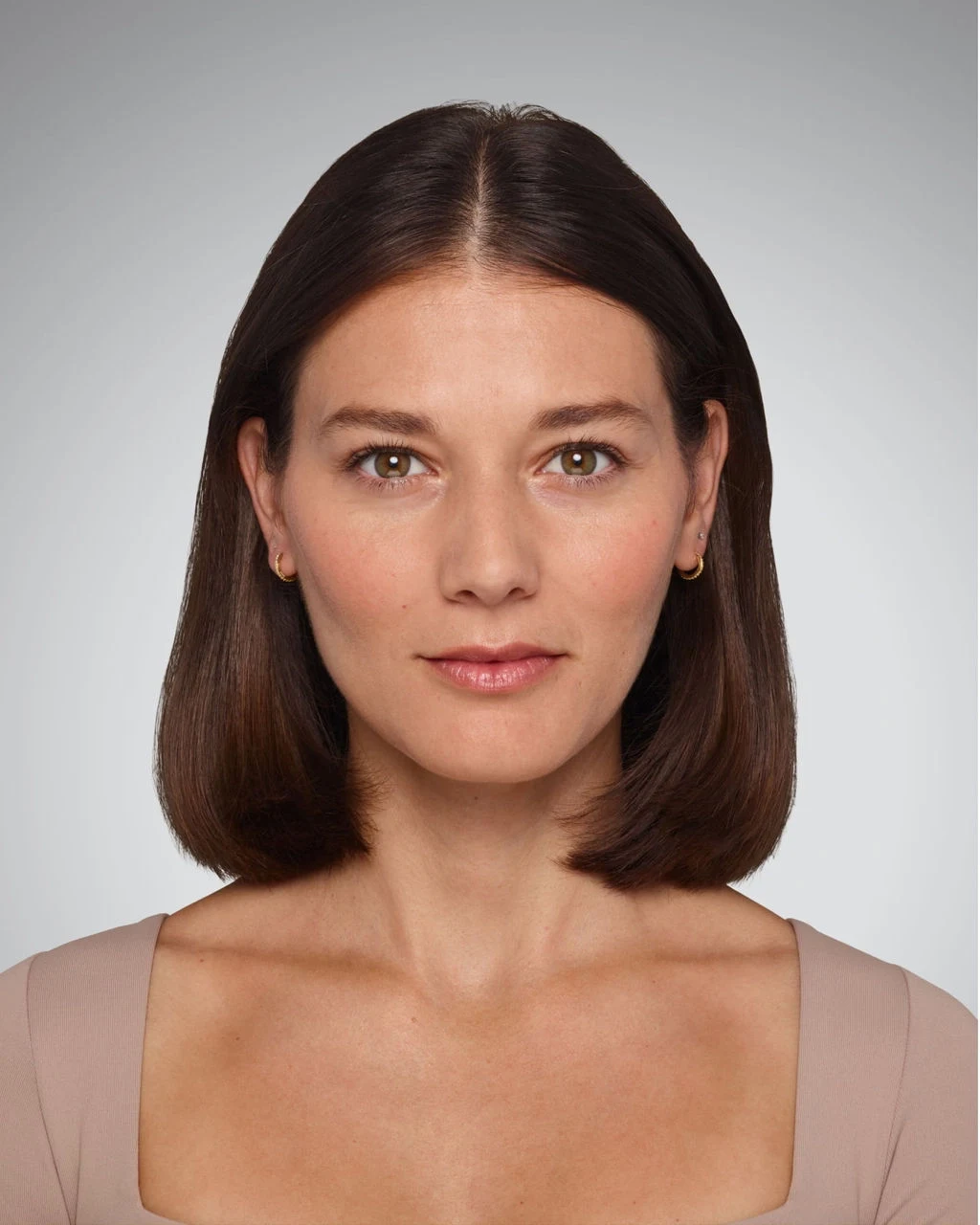 Before Volbella lip filler