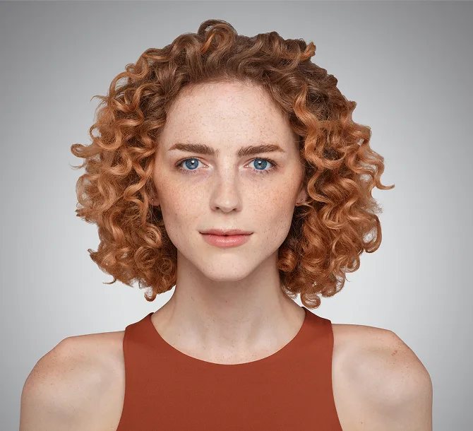 Before Voluma cheek filler