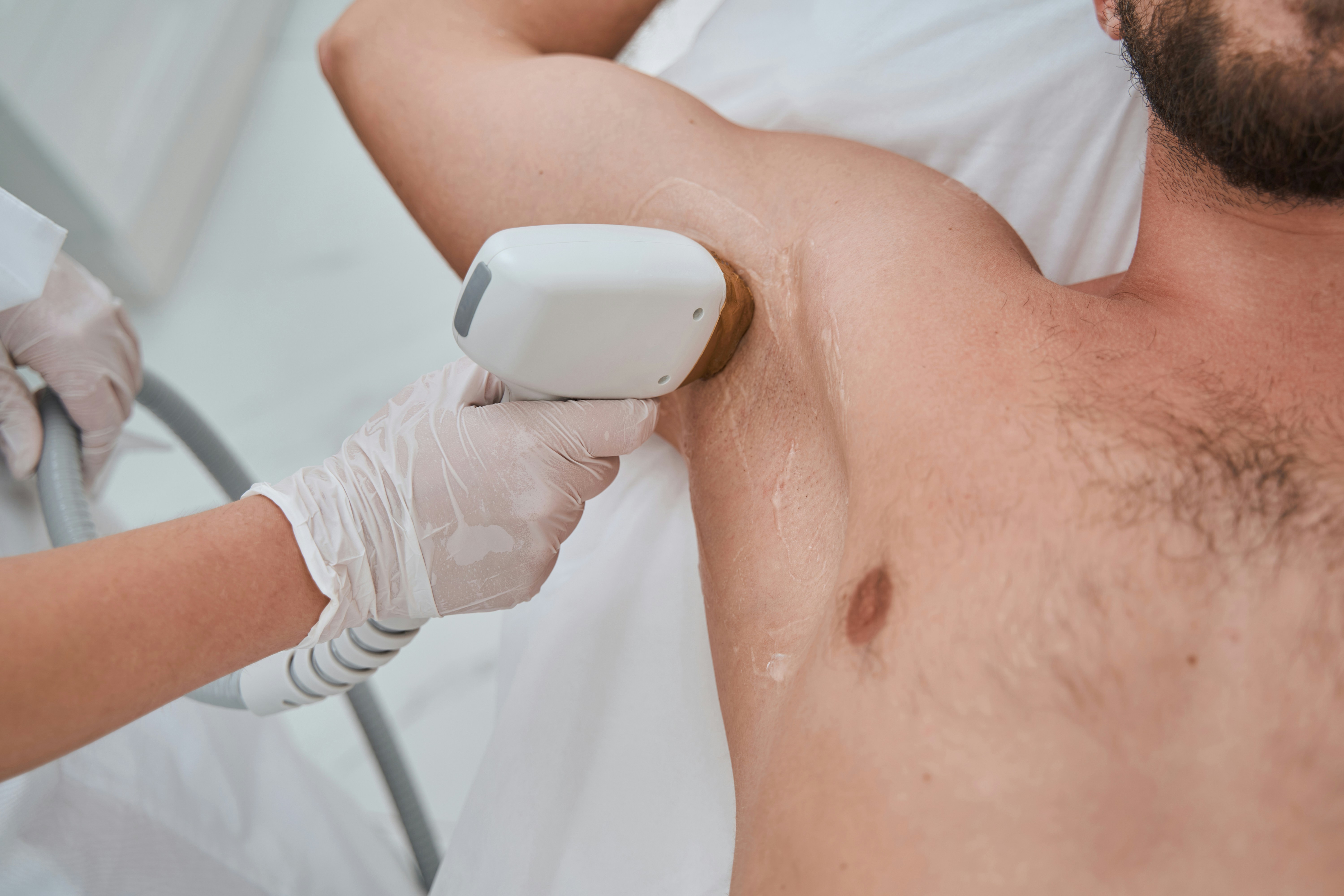 Laser hair removal for men at Florida Aesthetics Brandon FL