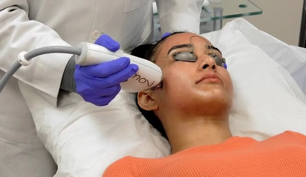 Moxi laser skin resurfacing at Florida Aesthetics Brandon FL