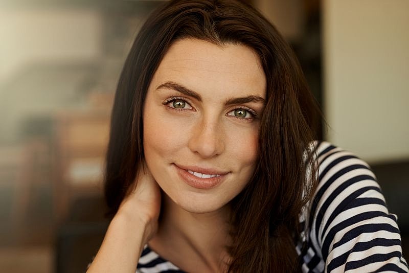 Radiesse filler treatment at Florida Aesthetics Brandon FL