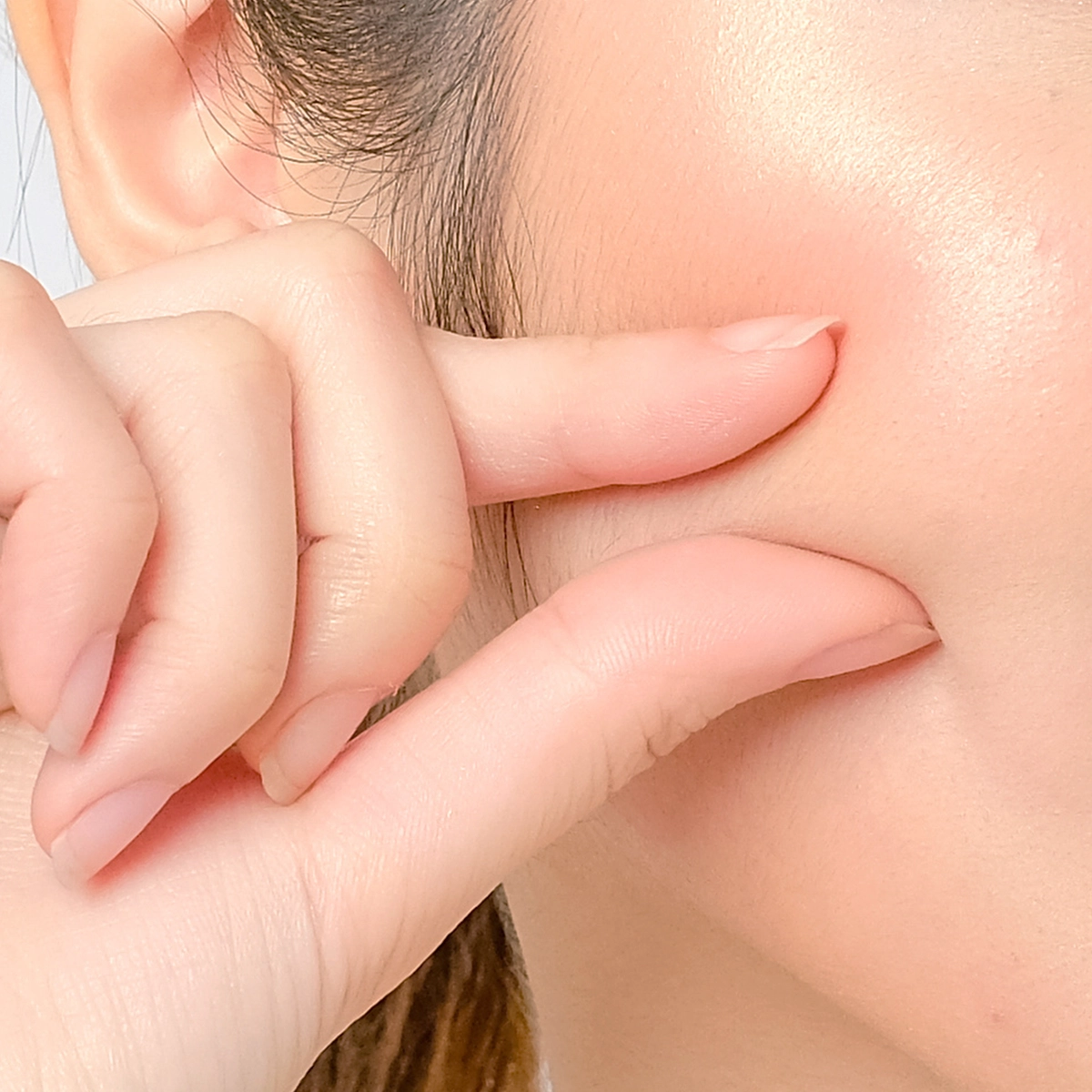 Radiesse at Florida Aesthetics