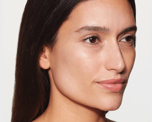 Sculptra collagen stimulator treatment at Florida Aesthetics Brandon FL