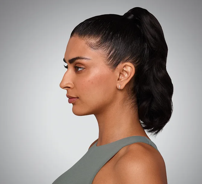 After SKINVIVE, smoother cheek skin side view