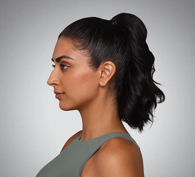 Before SKINVIVE, side profile cheek skin